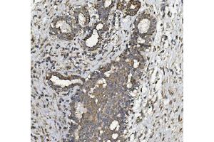 IHC analysis of REA/PHB2 using anti REA/PHB2 antibody (ABIN7599240).