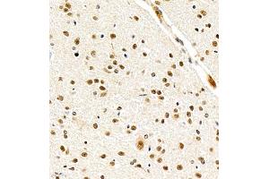 Immunohistochemistry of paraffin embedded mouse cerebellum using USP27 (ABIN7076113) at dilution of 1:700 (400x lens) (USP27X anticorps)