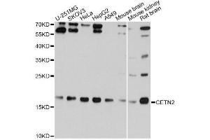 Western blot analysis of extracts of various cell lines, using CETN2 Antibody.