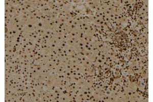 ABIN6274025 at 1/100 staining Mouse liver tissue by IHC-P.