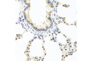 Immunohistochemistry of paraffin-embedded rat lung using DEDD antibody (ABIN5973422) at dilution of 1/100 (40x lens). (DEDD anticorps)