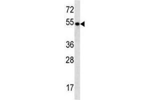 anti-TBC1D3E (AA 498-527) antibody