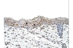 Arrestin B2 antibody was used for immunohistochemistry at a concentration of 4-8 ug/ml.