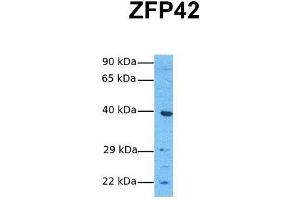 Host:  Rabbit  Target Name:  ZFP42  Sample Tissue:  Human Jurkat  Antibody Dilution:  1.