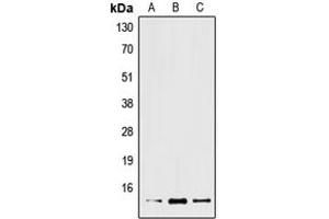 Western blot analysis of XCL2 expression in Jurkat (A), mouse liver (B), rat liver (C) whole cell lysates.