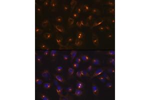 Immunofluorescence analysis of U-2 OS cells using RA Rabbit mAb (ABIN7269792) at dilution of 1:100 (40x lens). (RAB11A anticorps)