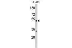 Western blot analysis of NR1I2 Antibody (Center) in HL-60 cell line lysates (35ug/lane). (NR1I2 anticorps  (Middle Region))