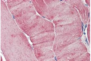 Human Skeletal Muscle: Formalin-Fixed, Paraffin-Embedded (FFPE)