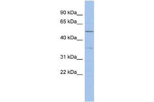WB Suggested Anti-ABHD15 Antibody Titration: 0. (ABHD15 anticorps  (Middle Region))