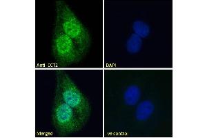 (ABIN185018) Immunofluorescence analysis of paraformaldehyde fixed U2OS cells, permeabilized with 0. (ECT2 anticorps  (N-Term))