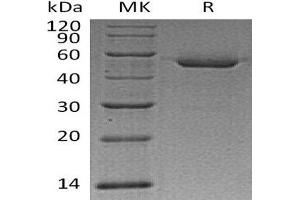 Western Blotting (WB) image for Cathepsin D (CTSD) protein (His tag) (ABIN7320739) (Cathepsin D Protein (CTSD) (His tag))