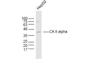 Human HepG2 cells probed with CK II alpha Polyclonal Antibody, unconjugated  at 1:300 overnight at 4°C followed by a conjugated secondary antibody at 1:10000 for 90 minutes at 37°C.