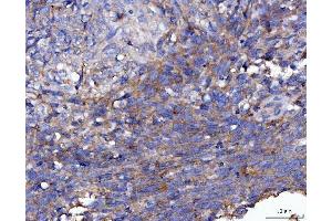 anti-Fibroblast Growth Factor Receptor 2 (FGFR2) (AA 22-368) antibody