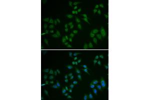 Immunofluorescence analysis of U2OS cell using TP63 antibody.