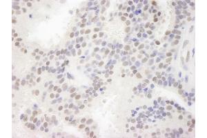 Immunohistochemistry (IHC) image for anti-Mastermind-Like 3 (MAML3) (C-Term) antibody (ABIN7448637)