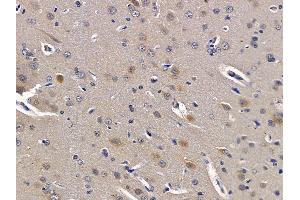 ABIN6259609 and ABIN6275532 at 1/100 staining rat brain tissue sections by IHC-P. (NIM1 anticorps  (C-Term))