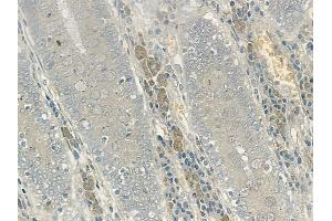 ABIN6256293 and ABIN6267140 at 1/100 staining human normal colon tissue by IHC-P.