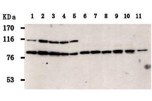Western Blotting (WB) image for anti-PRP3 Pre-mRNA Processing Factor 3 Homolog (PRPF3) antibody (ABIN1449201) (PRPF3 anticorps)