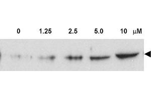 Figure. (CHEK2 anticorps  (pThr68))