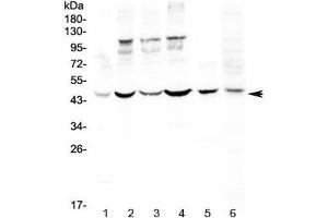 Western blot testing of human 1) HeLa, 2) MCF7, 3) HepG2, 4) A549, 5) rat spleen and 6) mouse thymus lysate with DC-SIGN antibody at 0. (DC-SIGN/CD209 anticorps)