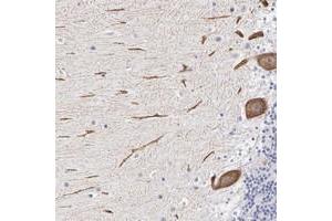 Immunohistochemical staining of human cerebellum with ELFN2 polyclonal antibody  shows strong cytoplasmic positivity in purkinje cells at 1:50-1:200 dilution. (ELFN2 anticorps)