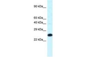 Image no. 1 for anti-Homeobox B9 (HOXB9) (C-Term) antibody (ABIN6747725) (HOXB9 anticorps  (C-Term))
