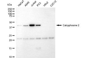 anti-Calcyphosine 2 (CAPS2) antibody