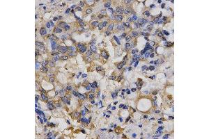 Immunohistochemistry (IHC) image for anti-Chloride Channel 5 (CLCN5) antibody (ABIN1876908) (Chloride Channel 5 anticorps)