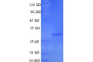 SDS-PAGE (SDS) image for Retinol Binding Protein 4, Plasma (RBP4) (AA 18-225) protein (His tag) (ABIN5713004)