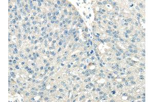 Immunohistochemistry (IHC) image for anti-Vacuolar Protein Sorting 36 (VPS36) antibody (ABIN5959967)