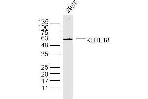 293T lysates probed with KLHL18 Polyclonal Antibody, unconjugated  at 1:300 overnight at 4°C followed by a conjugated secondary antibody for 60 minutes at 37°C.