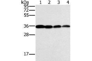 Western Blot analysis of Raji, Jurkat, 293T and hela cell using CENPV Polyclonal Antibody at dilution of 1:200 (CENPV anticorps)