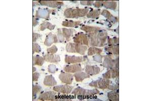 CTSK Antibody (Center E112) immunohistochemistry analysis in formalin fixed and paraffin embedded human skeletal muscle followed by peroxidase conjugation of the secondary antibody and DAB staining.