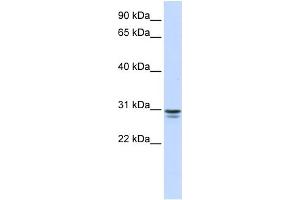 WB Suggested Anti-FFAR1 Antibody Titration:  0. (FFAR1 anticorps  (N-Term))