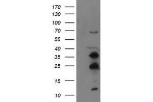 Image no. 3 for anti-Synovial Sarcoma, X Breakpoint 1 (SSX1) antibody (ABIN1501157) (SSX1 anticorps)