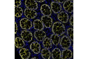 Immunofluorescence (IF) image for anti-Epithelial Cell Adhesion Molecule (EPCAM) (AA 264-314) antibody (ABIN7454025) (Recombinant EpCAM anticorps  (AA 264-314))