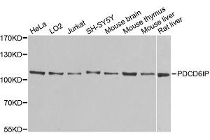 Western blot analysis of extracts of various cell lines, using PDCD6IP antibody (ABIN5971240) at 1/1000 dilution. (ALIX anticorps)