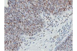 Image no. 7 for anti-Golgi Membrane Protein 1 (GOLM1) antibody (ABIN1498496)