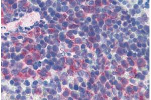 Mouse Spleen: Formalin-Fixed, Paraffin-Embedded (FFPE) (CD69 anticorps  (FITC))