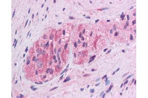Immunohistochemistry (IHC) image for anti-Wingless-Type MMTV Integration Site Family, Member 5A (WNT5A) (Middle Region) antibody (ABIN2779470)