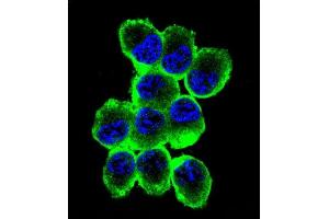 Confocal immunofluorescent analysis of MBP Antibody (Ascites) ABIN1539854 with NCI- cell followed by Alexa Fluor® 488-conjugated goat anti-mouse lgG (green). (MBP anticorps)