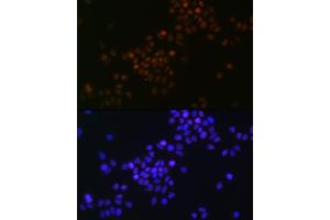 Immunofluorescence analysis of HeLa cells using c-Myc Rabbit mAb (ABIN7268711) at dilution of 1:100 (40x lens).