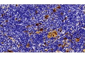 Detection of GAL3 in Rat Spleen Tissue using Polyclonal Antibody to Galectin 3 (GAL3)