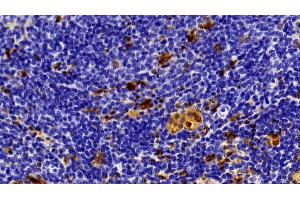 Detection of GAL3 in Rat Spleen Tissue using Polyclonal Antibody to Galectin 3 (GAL3) (Galectin 3 anticorps  (AA 1-262))