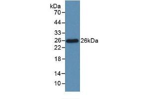 Detection of Recombinant Bcl2L, Rat using Monoclonal Antibody to B-Cell CLL/Lymphoma 2 Like Protein (Bcl2L) (BCL2L1 anticorps  (AA 2-212))