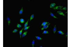 Immunofluorescent analysis of Hela cells using ABIN7170239 at dilution of 1:100 and Alexa Fluor 488-congugated AffiniPure Goat Anti-Rabbit IgG(H+L) (SLC35F6 anticorps  (AA 337-371))