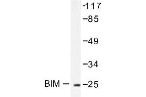 Image no. 1 for anti-BCL2-Like 11 (Apoptosis Facilitator) (BCL2L11) antibody (ABIN265330) (BIM anticorps)