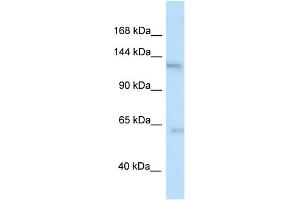 WB Suggested Anti-Ttbk2 Antibody   Titration: 1. (TTBK2 anticorps  (N-Term))