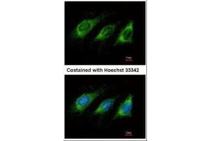 ICC/IF Image Immunofluorescence analysis of methanol-fixed HeLa, using AICDA, antibody at 1:500 dilution.