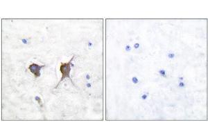 Immunohistochemistry (IHC) image for anti-BCL2-Associated X Protein (BAX) (N-Term) antibody (ABIN1848438) (BAX anticorps  (N-Term))